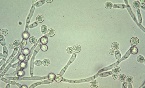 Figure 22