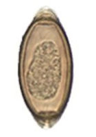 A Tapeworm Egg Found In Faecal Smear From A Gouldian Finch