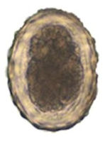 Ascaris Suum (The Large Roundworm) Egg