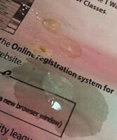 A Stool With Excessive Polyuria