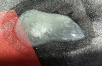 Mucous or Slimy Stool, Polyuria or Yolk Sac