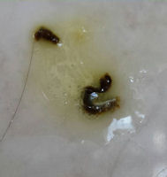 Stool From A Bird With A Bacterial Infection, Also Old Blood. Excessive Urine With Bubbles