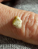 A Single Stool Showing Bubbles, Taken From A Finch With A Gastrointestinal (GI) problem