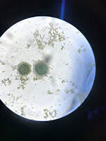 Undigested Plant Matter Viewed Under A Microscope, Faecal Smear Of A Hecks Grass Finch